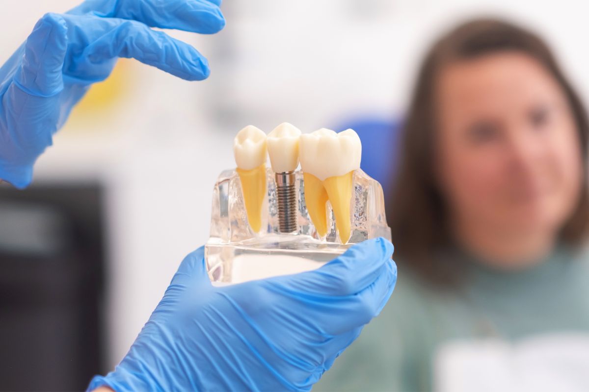 Zahnimplantate (1)
